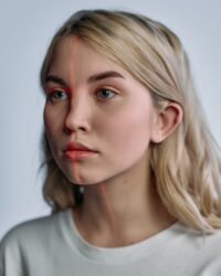 PRP (PLASMA RICO EN PLAQUETAS)